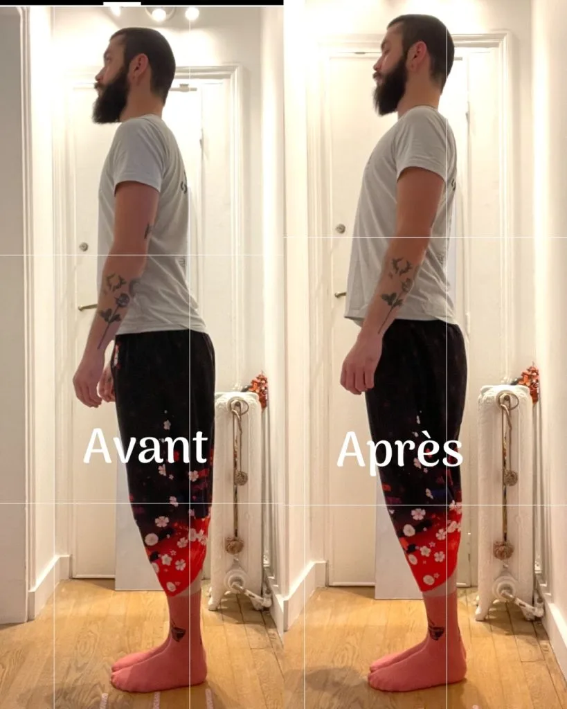 résultats avant/après méthode re-set